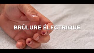 YLEA  Maquillage de Secourisme  Comment réaliser une brûlure électrique [upl. by Griz]