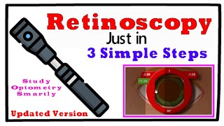 Updated Retinoscopy just in 3 Simple Steps [upl. by Immij40]