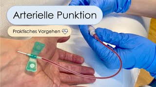 Arterielle Punktion  Schritt für Schritt Allen Test arterielle BGA Aradialis Tipps und Tricks [upl. by Bear]