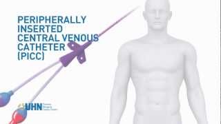 Learn About the Peripherally Inserted Central Venous Catheter PICC [upl. by Nivla]