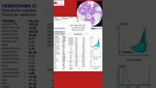 Interpreta el siguiente hemograma hematologia medicina [upl. by Eiduam]