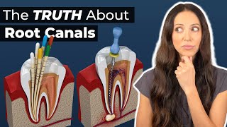 What to Expect During a Root Canal Procedure [upl. by Ahsilav719]