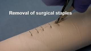 Placing and removing surgical wound closure staples [upl. by Camel]