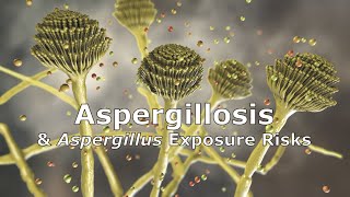 Aspergillosis and Aspergillus Exposure Risks [upl. by Mailiw]