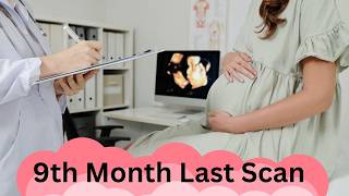 9th Month Pregnancy Ultrasound Last Scan Before Baby’s Arrival pregnancy pregnant dailyvlog [upl. by Jessen]