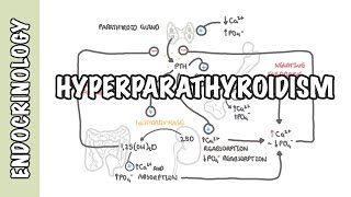 Hyperparathyroidism and the different types causes pathophysiology treatment [upl. by Riba918]