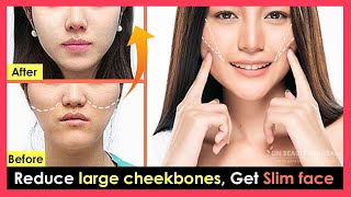 How to reduce large cheekbones and high cheekbones to make the face look slimmer No surgery [upl. by Edgerton]