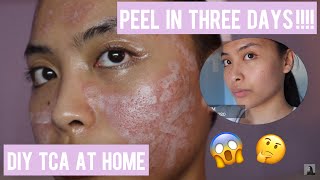 FIRST TIME DIY TCA 50  DEMOampREVIEW  NO HYPERPIGMENTATION ‼️  Feat Banisher 20 [upl. by Ymereg110]