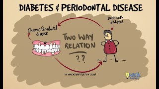 Diabetes and periodontitis The two way relationship [upl. by Omik]