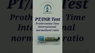 PTINR Test Prothrombin Time  International normalized ratio saxenalabtechnician easyshorts [upl. by Einhpad293]