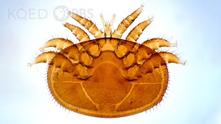 Varroa Mites Are a Honeybees 8Legged Nightmare  Deep Look [upl. by Ademordna]