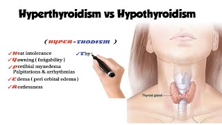 hyperthyroidism vs hypothyroidism [upl. by Giguere449]