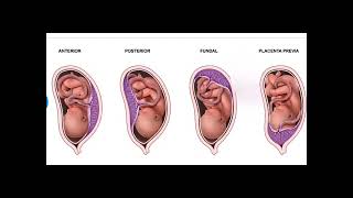 Anterior Placenta means baby Girl or Boy Posterior Placenta means baby Girl or Boy PlacentaPrevia [upl. by Gerik]