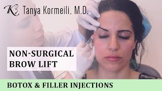 Nonsurgical Brow Lift [upl. by Rabiah]