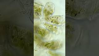 Stalked Ciliates and Volvox Under Microscope microbiology microscope science [upl. by Tnilc]