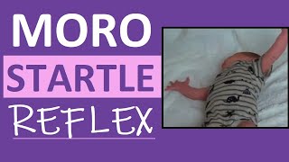 Moro Reflex Newborn Test  Startle Reflex  Pediatric Nursing Assessment [upl. by Ayardna]