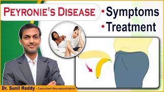 What is The Best Treatment for Peyronies Disease  Peyronies Shockwave Treatment  ED Cure [upl. by Awhsoj]