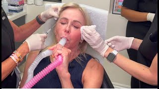 Nitrous OxidePain Management Cosmetic Procedures Allenby Cosmetic Dermatology Delray Beach FL [upl. by Mellette]