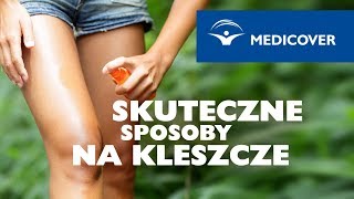 Kleszcz – skuteczne sposoby na kleszcze [upl. by Raynata]