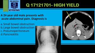 Pneumoperitoneum  CT Abdomen [upl. by Wohlert]