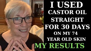 I USED CASTOR OIL FOR 30 DAYS ON MY 74YEAROLD SKIN  MY RESULTS [upl. by Alletniuq]