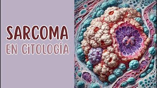 Sarcoma en citología [upl. by Gillmore]