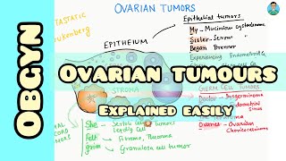 Ovarian Tumorsclassification easy mnemonic for USMLE [upl. by Anialahs]