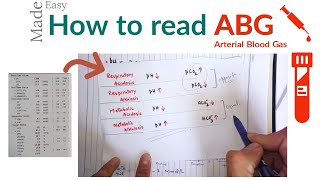 How to check ABG or arterial blood gas  ABG Interpretation [upl. by Leila537]