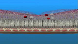 Macular Edema and Ischemia [upl. by Issirk407]