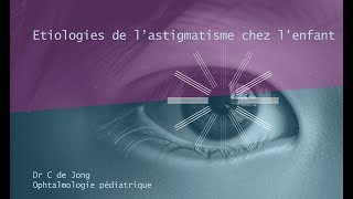 Etiologies de lastigmatisme chez lenfant [upl. by Nahtannoj]