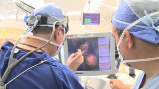 The Deep Brain Stimulation DBS Journey  Short Version [upl. by Uund682]