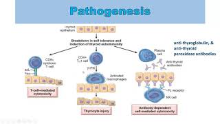 Pathogenesis of Hashimoto thyroiditis [upl. by Dion400]