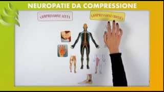 Neuropatie da Compressione [upl. by Linnet674]