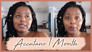 Accutane Journey  1 MONTH Accutane before and after  Roaccutane Mild Acne  Dark skin [upl. by Luhar]