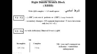 ECG features of RBBB [upl. by Atilemrac]