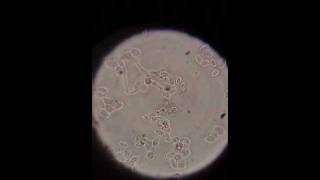 Spores under 2000x magnification [upl. by Goda]