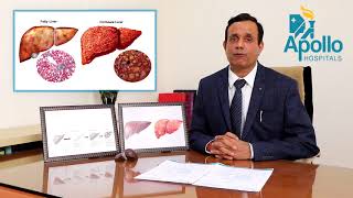 Liver diseases preventionprotection by Dr Shravan Bohra Liver Specialist at Apollo Ahmedabad [upl. by Anasxor]