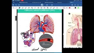 COPD pathology p1 [upl. by Neelon29]