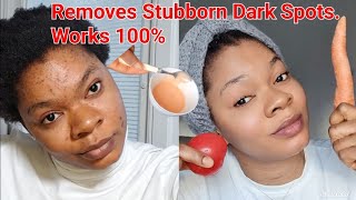 How to remove dark spotsacne amp pimples You will forever look YOUNGER skincare diy darkspots [upl. by Ibrad323]