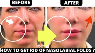 GET RID OF LAUGH LINES  FACE LIFTING EXERCISES FOR WRINKLES NASAL FOLDS  EASY STEP [upl. by Rona]