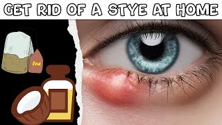 How To Get Rid Of A Stye At Home Natural Remedies For Stye Best Ways To Get Rid Of A Stye Easily [upl. by Devan]