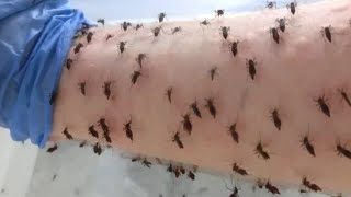 Cómo hacer repelente casero para mosquitos argentina noticias shorts [upl. by Eiresed]