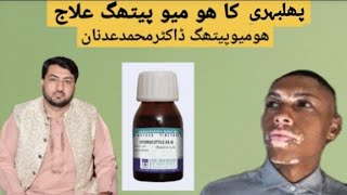 Leucoderma Ka Treatment  Homoeo Dr Adnan [upl. by Patience]