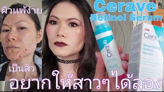 รีวิว  Cerave Retinol Serum ผิวแพ้ง่าย  ผิวเป็นสิว  รอยดำรวยแดงจากสิว 👍🥰 [upl. by Bayly812]