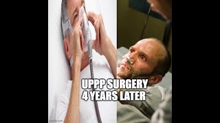 UPPP SURGERY 4 YEARS LATER [upl. by Dowlen881]