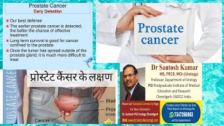 Prostate cancer Early Symptoms  प्रोस्टेट कैंसर के शुरुआती लक्षण  DrProfSantosh Kumar PGI [upl. by Denni]