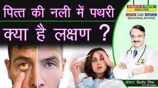 पित की नली में पथरी के क्या है लक्षण  BILE DUCT STONES SYMPTOMS [upl. by Winonah]