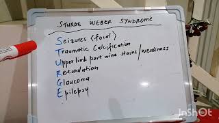 Mnemonic 8  Sturge Weber Syndrome [upl. by Weinman467]