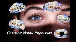 Common VISION problems and WHY they happen  eyesight [upl. by Millwater588]