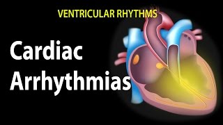 Cardiac Arrhythmias Animation [upl. by Anceline]